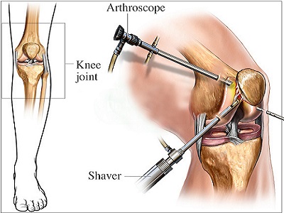 Orthopaedic / Arthroscopy